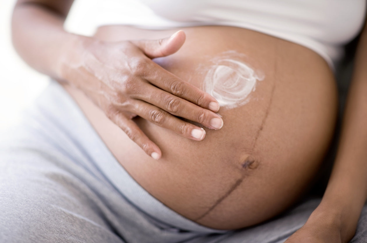 Smagliature in gravidanza: come prevenirle